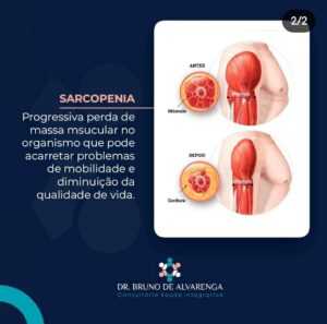 ilustração com explicação sobre a sarcopenia